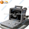 Portable LED ultrasound Hospital Equipment